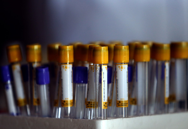Influenza Aviária: Estado do Rio tem dois novos casos confirmados de H1N5 em aves silvestres