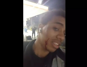 VÍDEO: motoboy diz ter levado tiro no rosto ao fazer entrega em comunidade no Rio