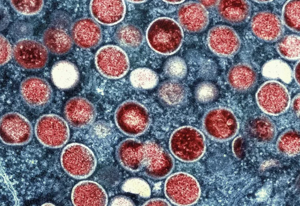‘A gente não parte do zero’, diz presidente do Butantan sobre prevenção à mpox no Brasil