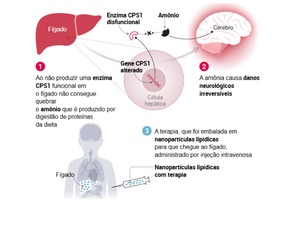 Primeiro paciente tem seu DNA reeditado e consegue melhorar de doença rara
