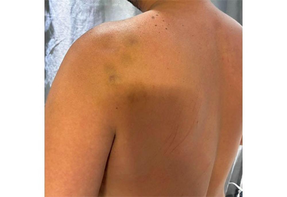 Jornalista Maicon Salles é assaltado e agredido próximo à Via Light, em Nova Iguaçu