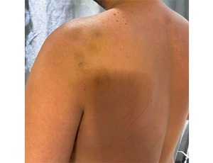 Jornalista Maicon Salles é assaltado e agredido próximo à Via Light, em Nova Iguaçu