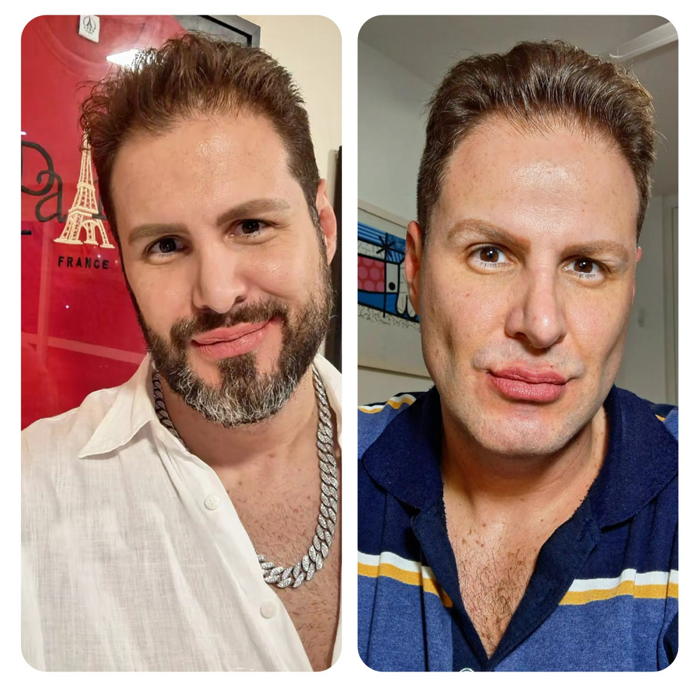 Bernardo Langlott retira a barba e levanta debate sobre o GAY PADRÃO: 