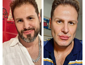 Bernardo Langlott retira a barba e levanta debate sobre o GAY PADRÃO: 