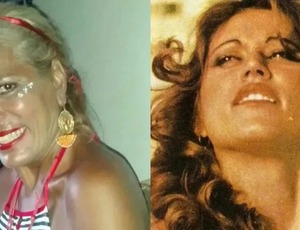 Ex-chacrete morre após um mês internada por ataque de pitbull do filho