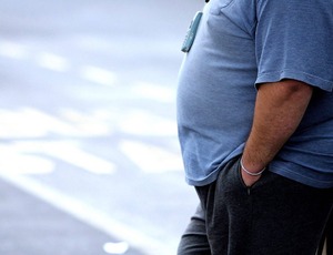 Obesidade aumenta presença de biomarcadores para Alzheimer 
