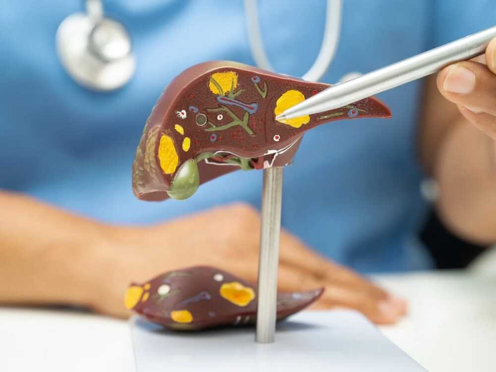 Esteatose hepática: A doença silenciosa difícil de tratar.