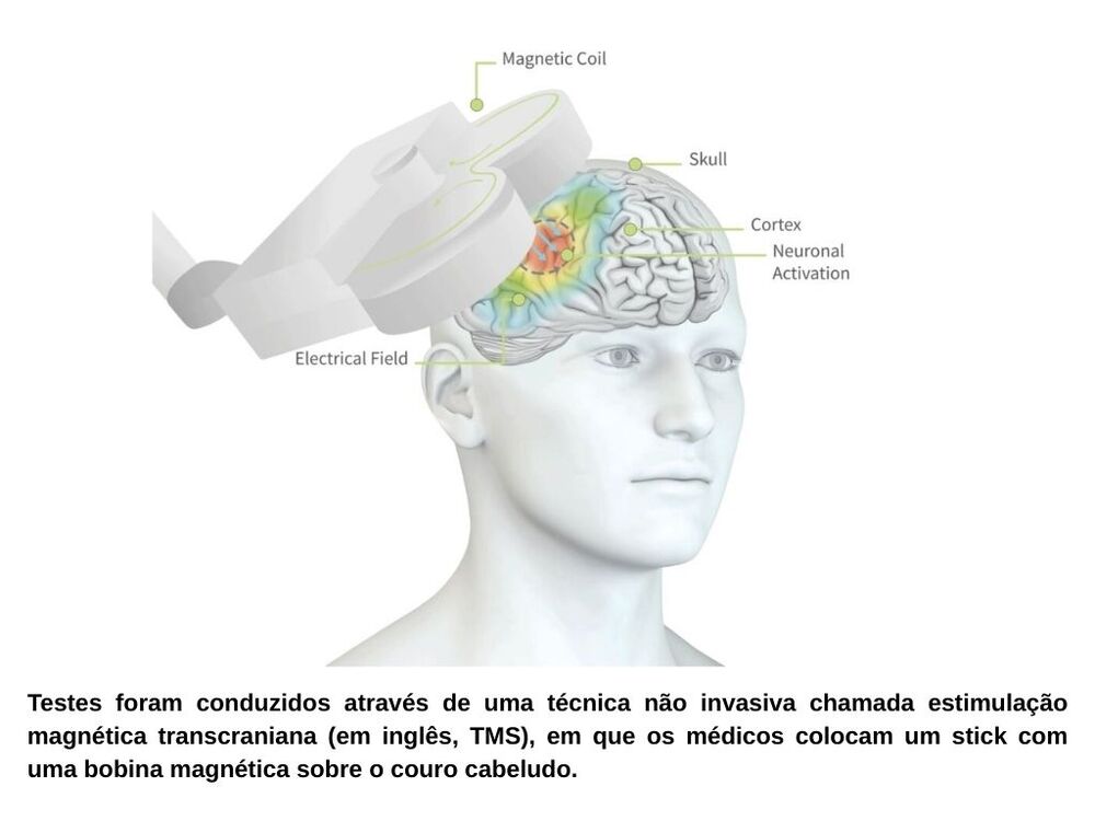 Cientistas descobrem rede cerebral que pode ser a base fisiológica para a doença de Parkinson.