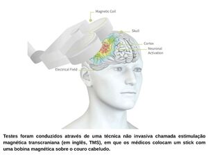 Cientistas descobrem rede cerebral que pode ser a base fisiológica para a doença de Parkinson.