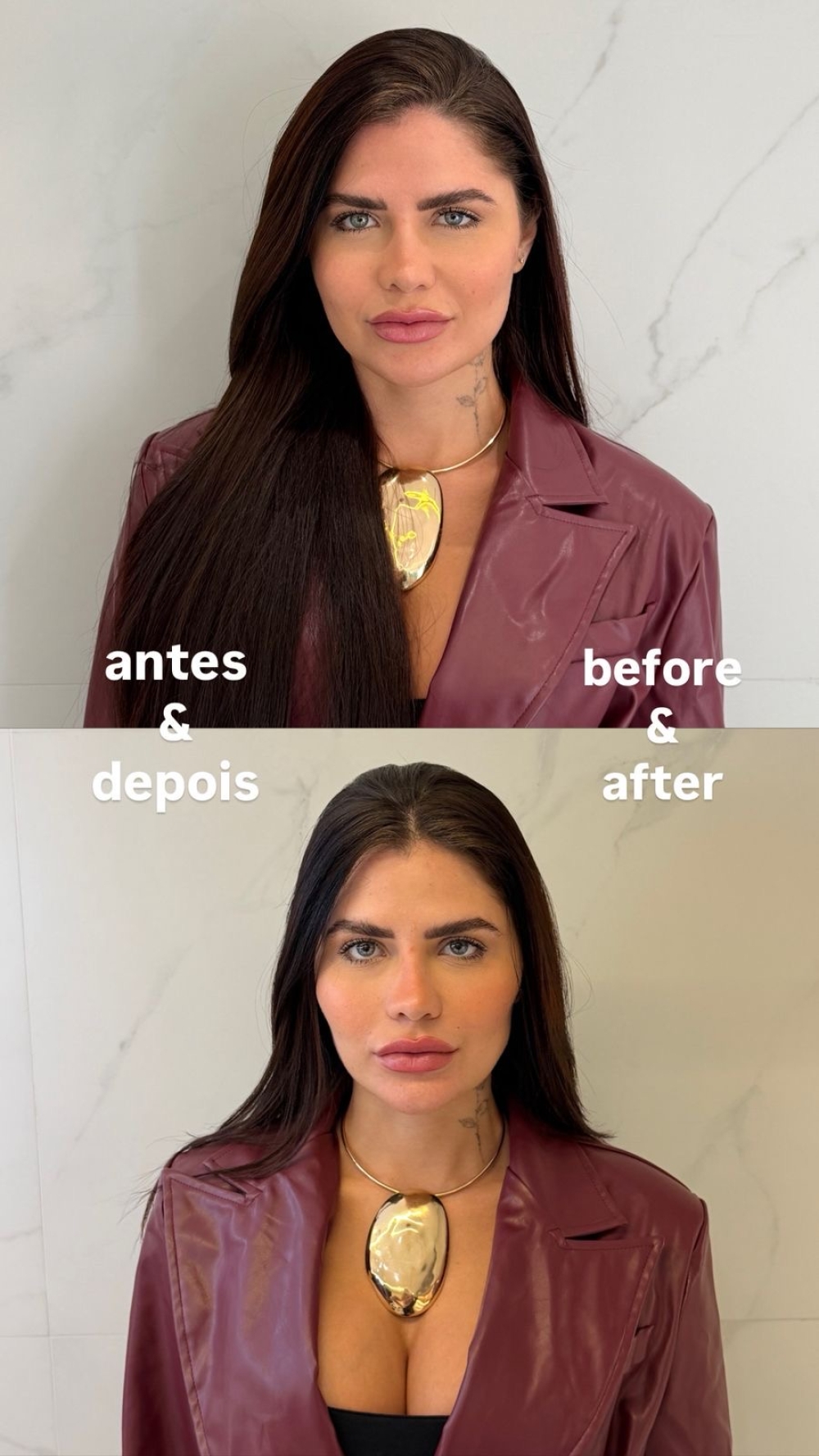 Influenciadora Julia Sampaio aposta em retoque natural de harmonização facial após dois anos sem procedimentos