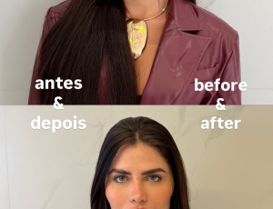 Influenciadora Julia Sampaio aposta em retoque natural de harmonização facial após dois anos sem procedimentos