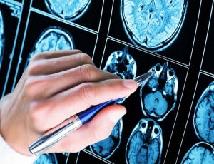 Mais de 50% dos diagnósticos de autismo ocorrem antes dos 5 anos de idade