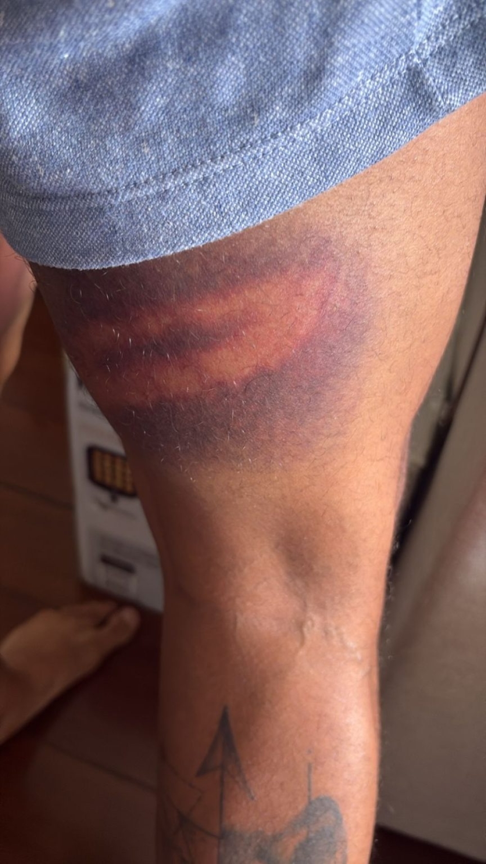 Vereador Rick Azevedo leva porrada de policiais militares e registra queixa de agressão contra a PM