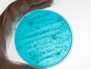 Alerta sobre superbactéria acende preocupação no Brasil