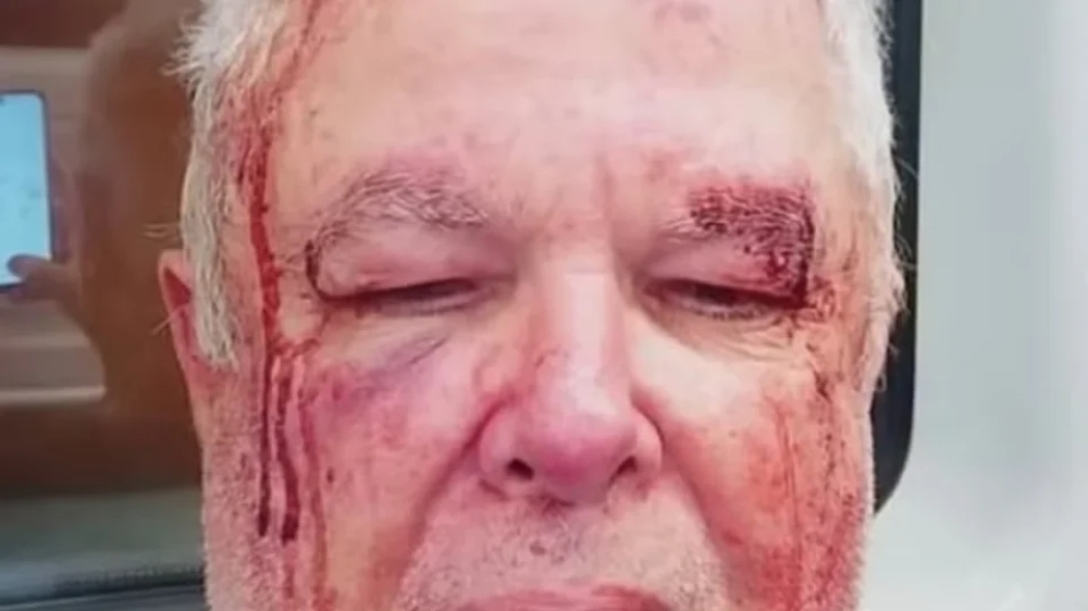 Polícia investiga agressão a idoso por motivação política em Copacabana (RJ)