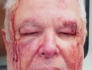Polícia investiga agressão a idoso por motivação política em Copacabana (RJ)