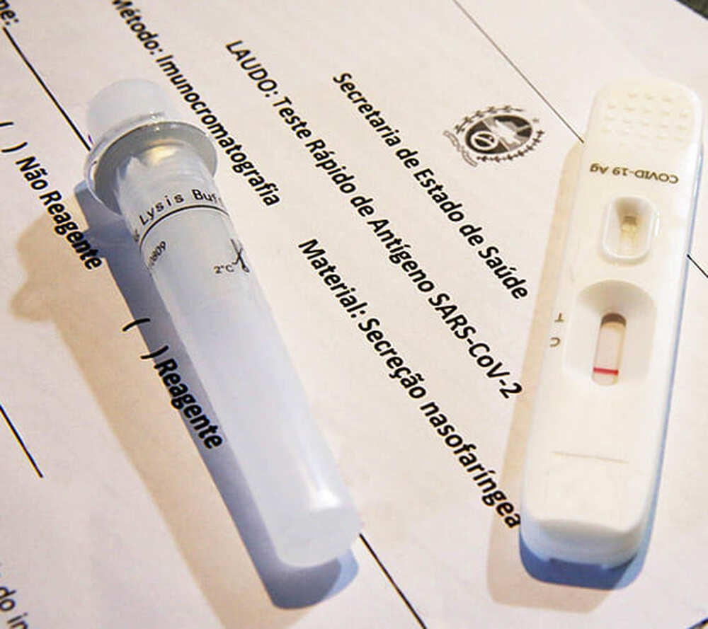 Governo do Estado amplia nesta sexta-feira, dia 14, oferta de testes para Covid-19