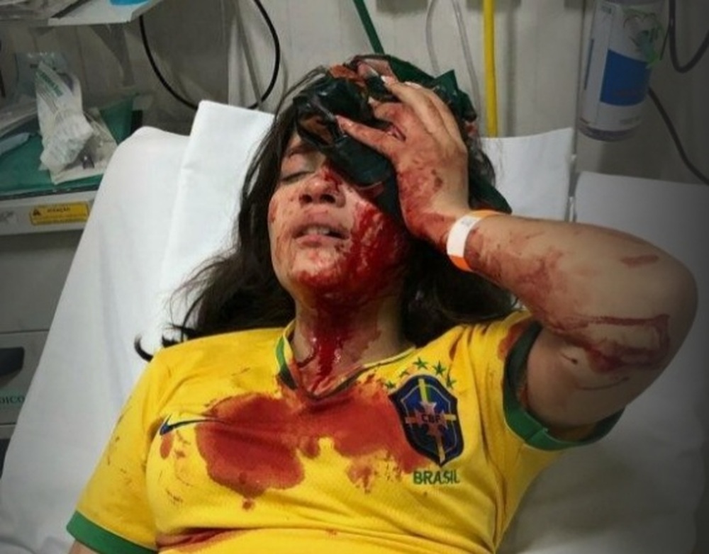 MENINA DE 13 ANOS, APOIADORA DE BOLSONARO É ATACADA A PEDRADA POR PETISTAS